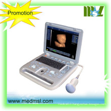 MSLCU18-2015 New and best 3D&4D portable ultrasound machine used in Human and vet